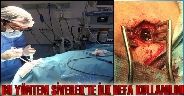 Siverek Devlet Hastanesinde Bir İlk Yaşandı