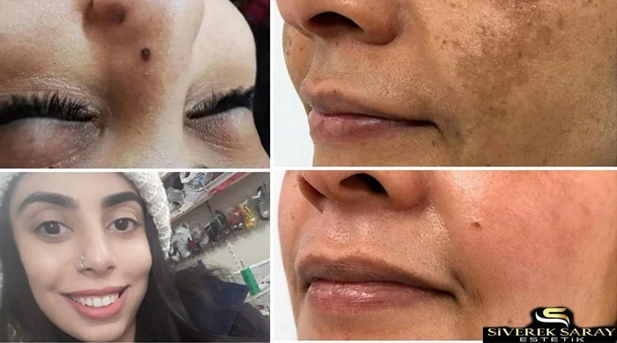 Estetik ve cilt bakımı uygulamalarına ilgi artıyor